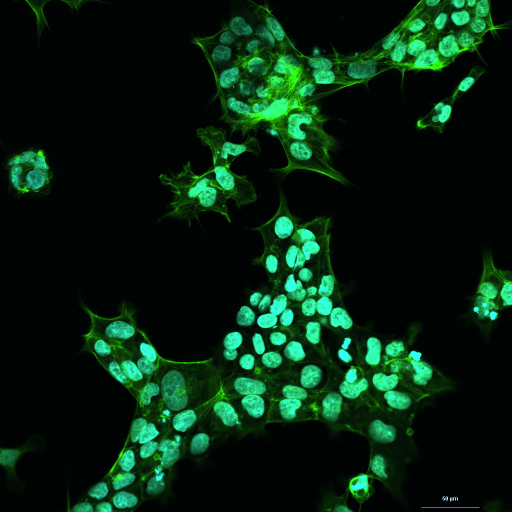 Fluorescence — DAPI/actine